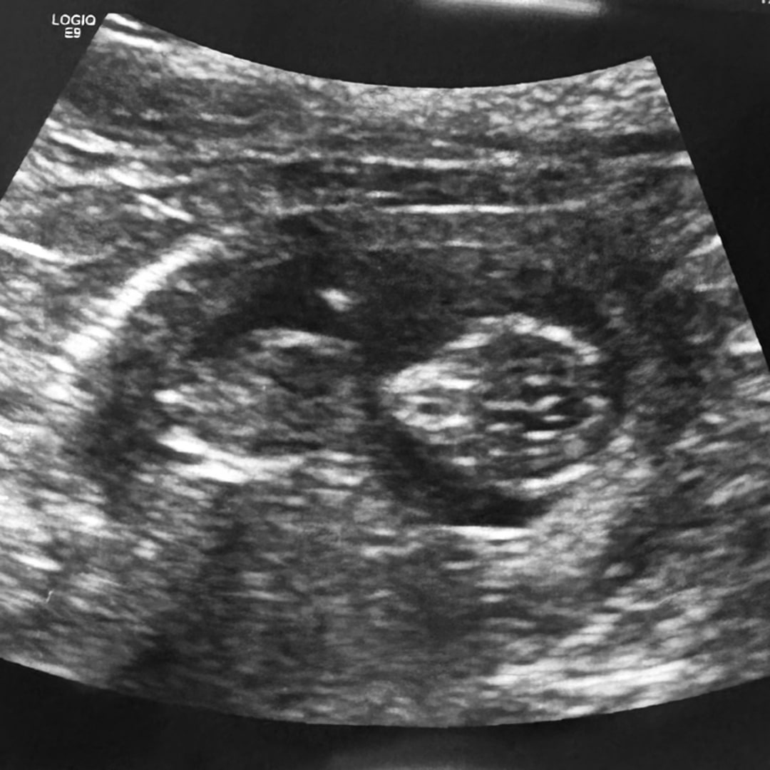 Photo shared by Alex for their Babylist baby registry.
