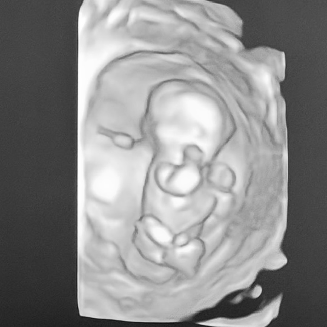 Photo shared by Victoria for their Babylist baby registry.