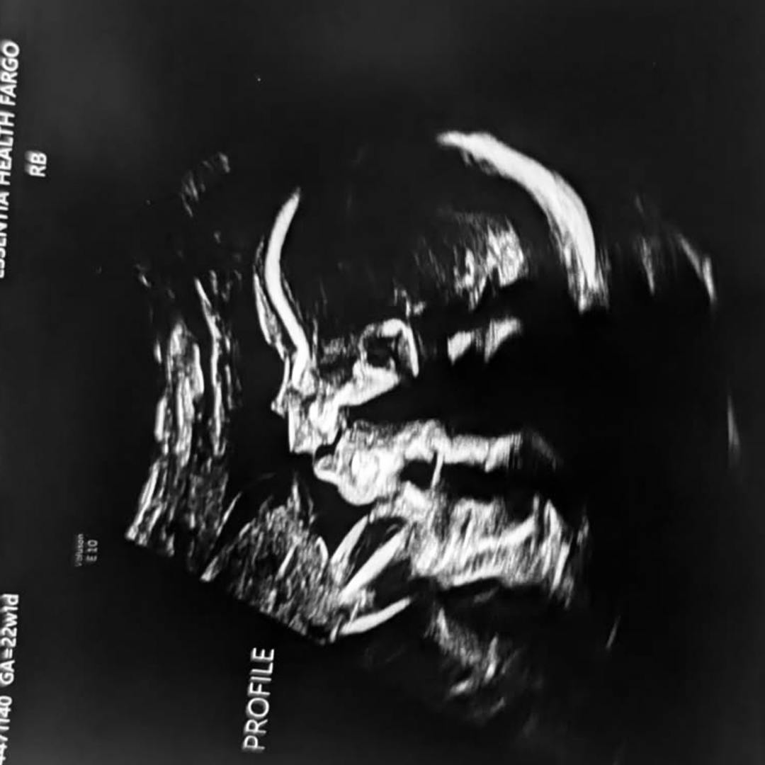 Photo shared by Shelby L. for their Babylist baby registry.