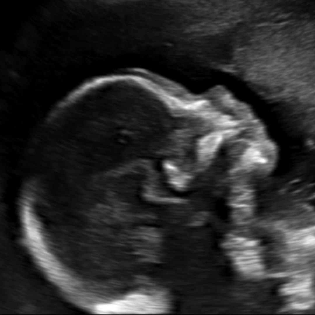 Photo shared by Rocky for their Babylist baby registry.