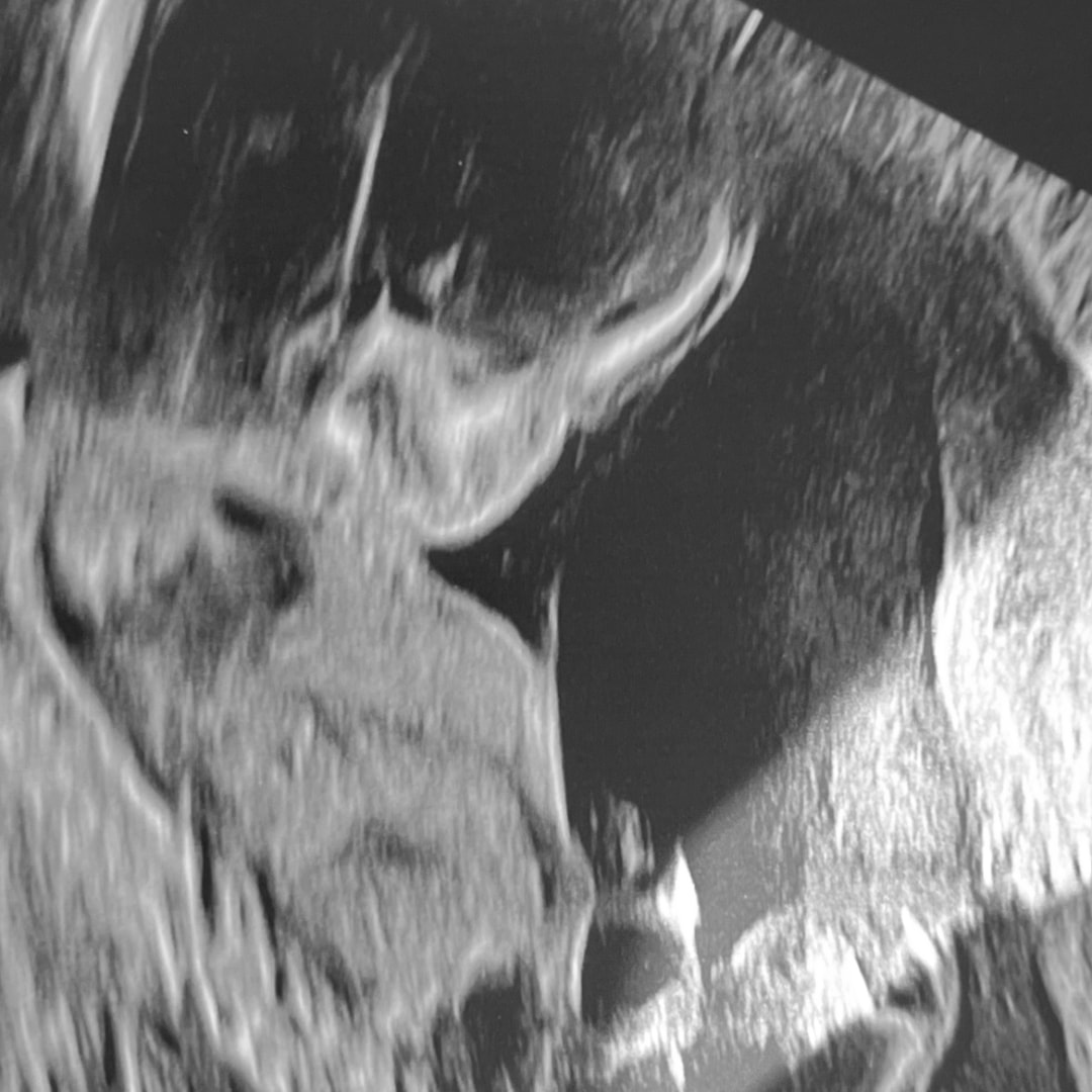 Photo shared by Maria for their Babylist baby registry.