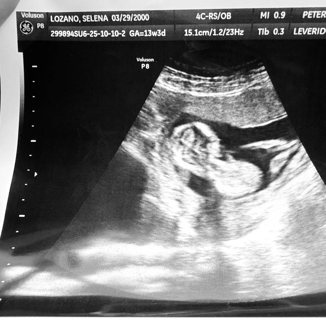 Photo shared by Selena for their Babylist baby registry.