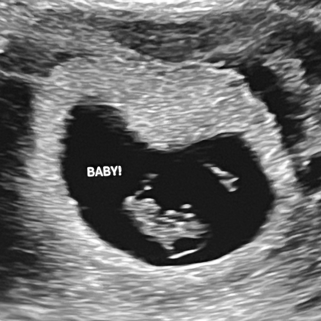 Photo shared by Rachel for their Babylist baby registry.