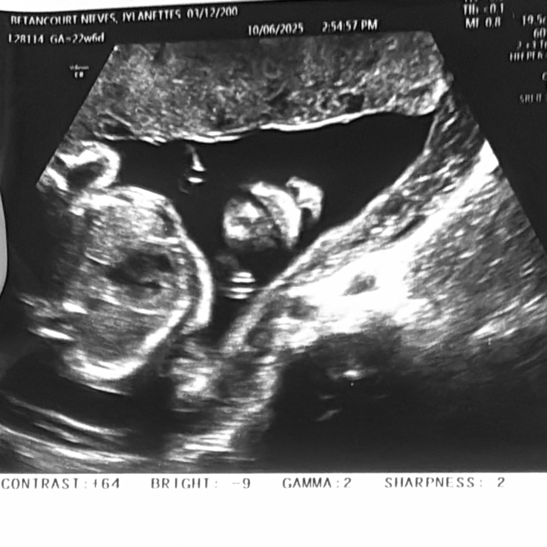 Photo shared by Jylanettes for their Babylist baby registry.