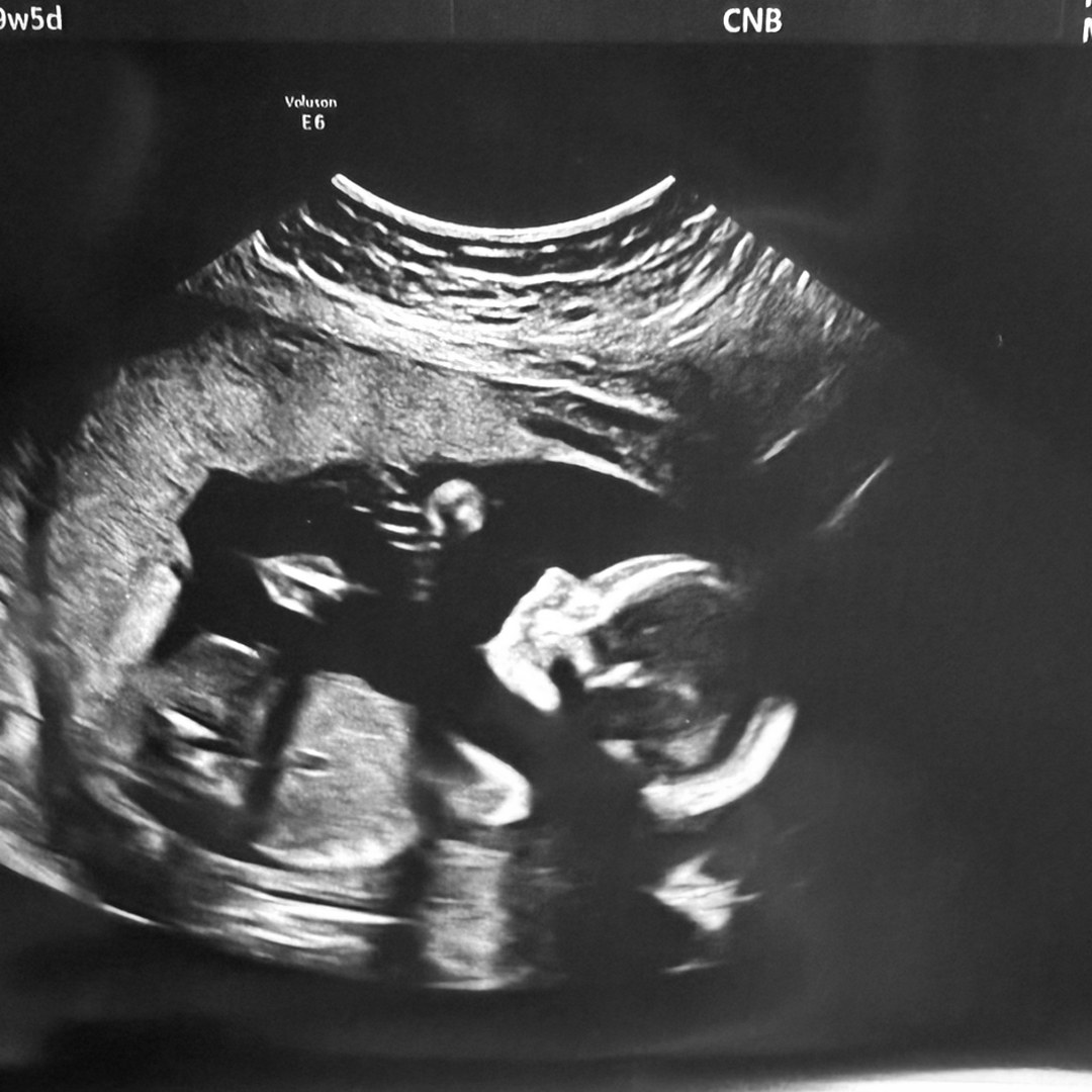 Photo shared by Kelly for their Babylist baby registry.