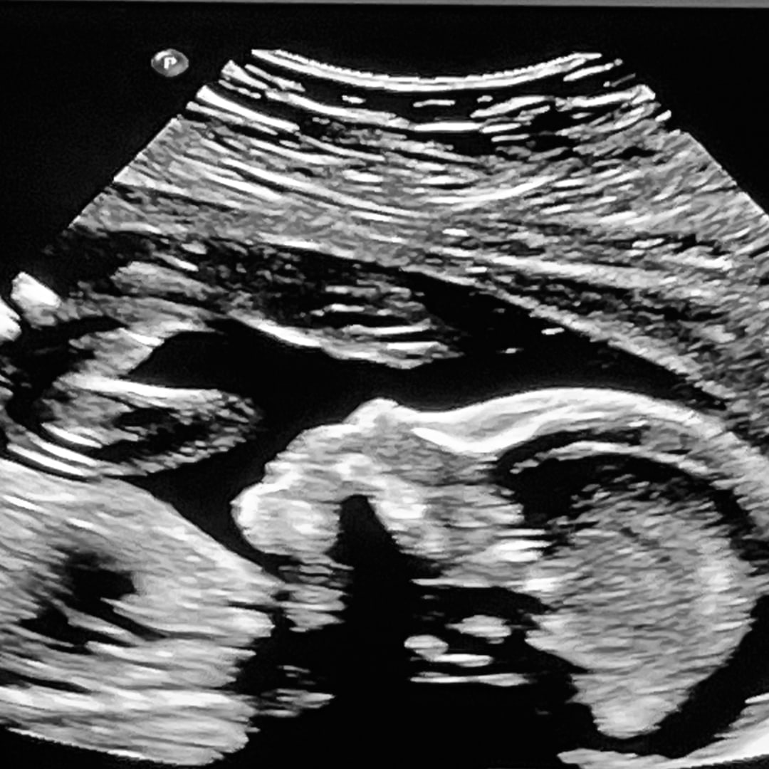 Photo shared by Joey for their Babylist baby registry.