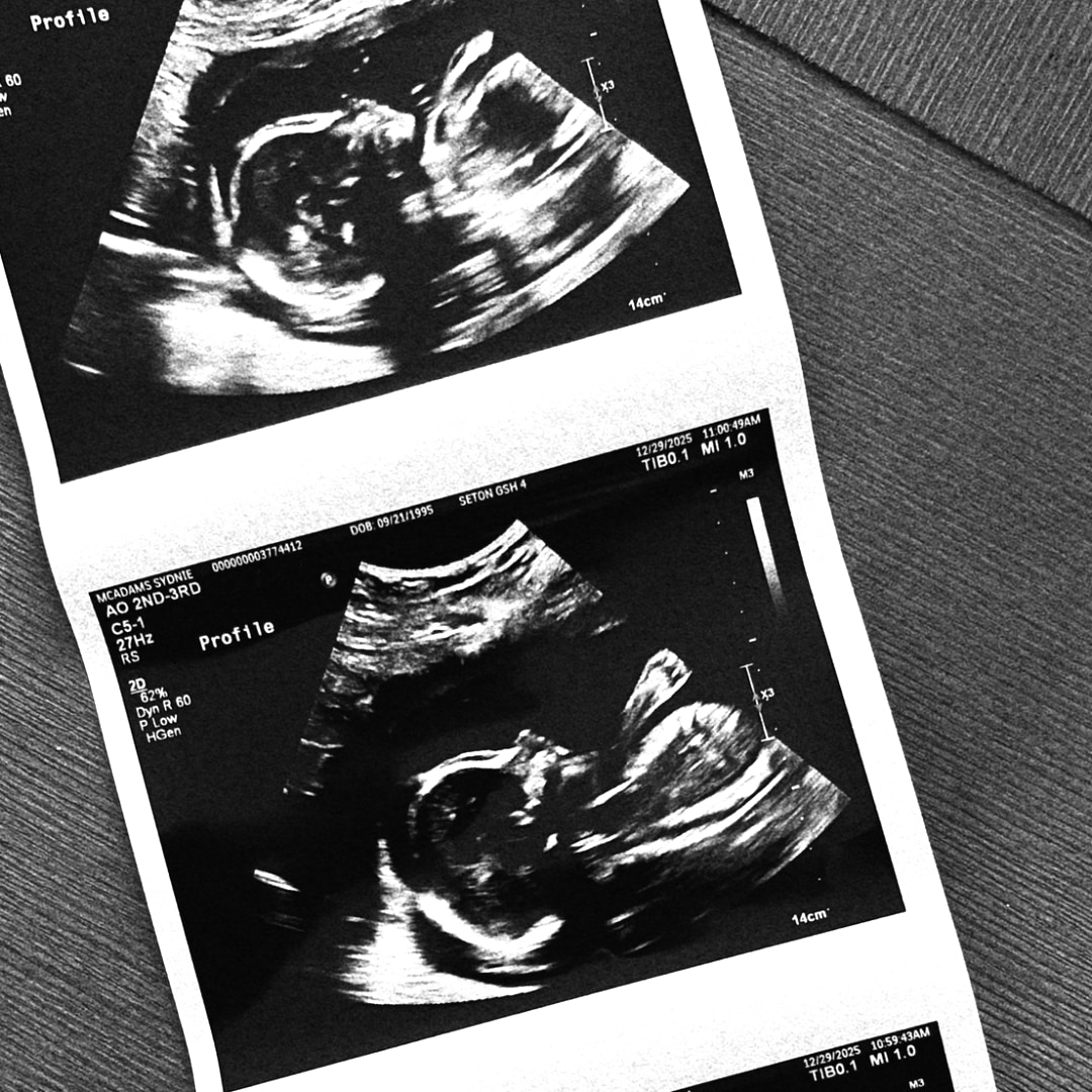 Photo shared by Sydnie for their Babylist baby registry.