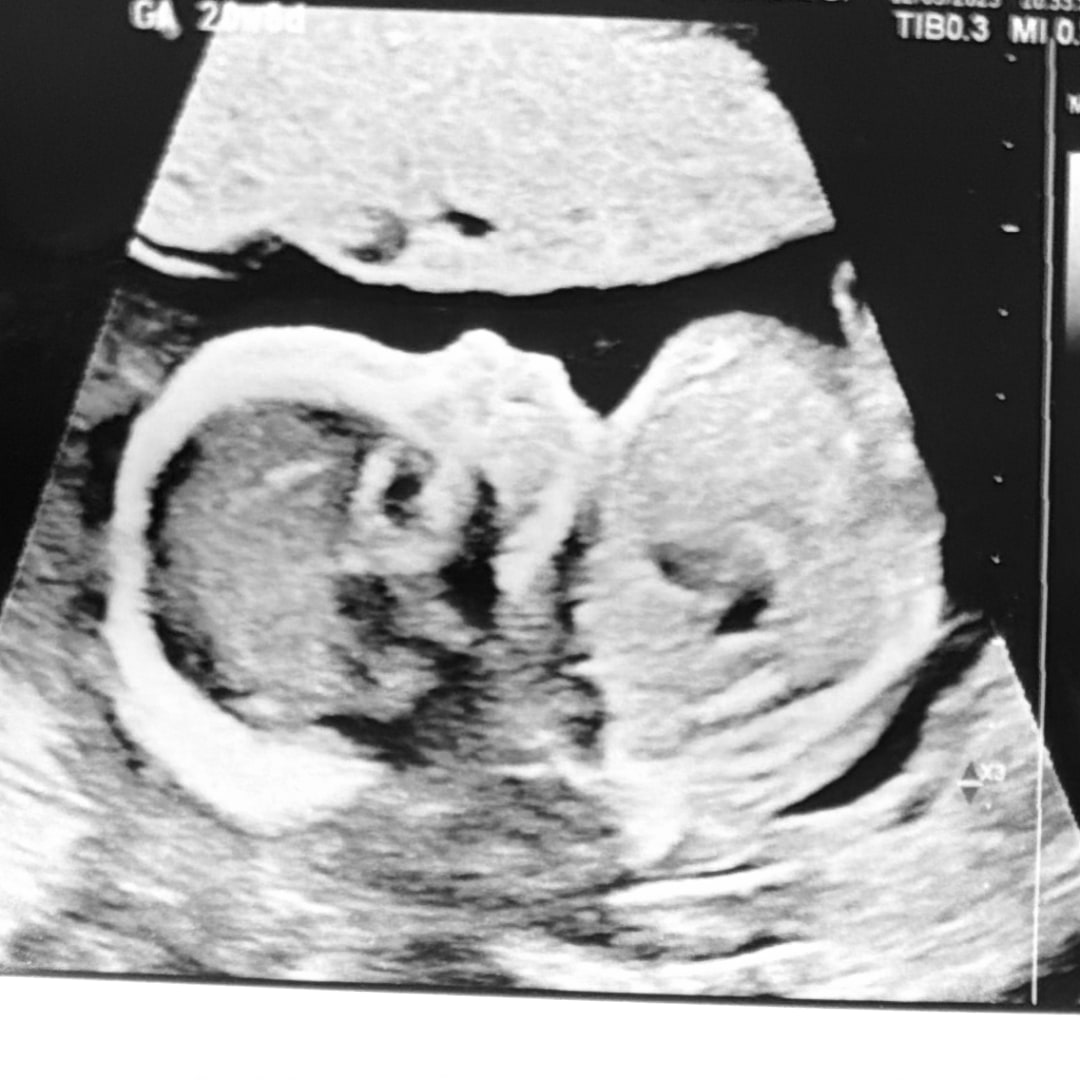 Photo shared by Jariah for their Babylist baby registry.