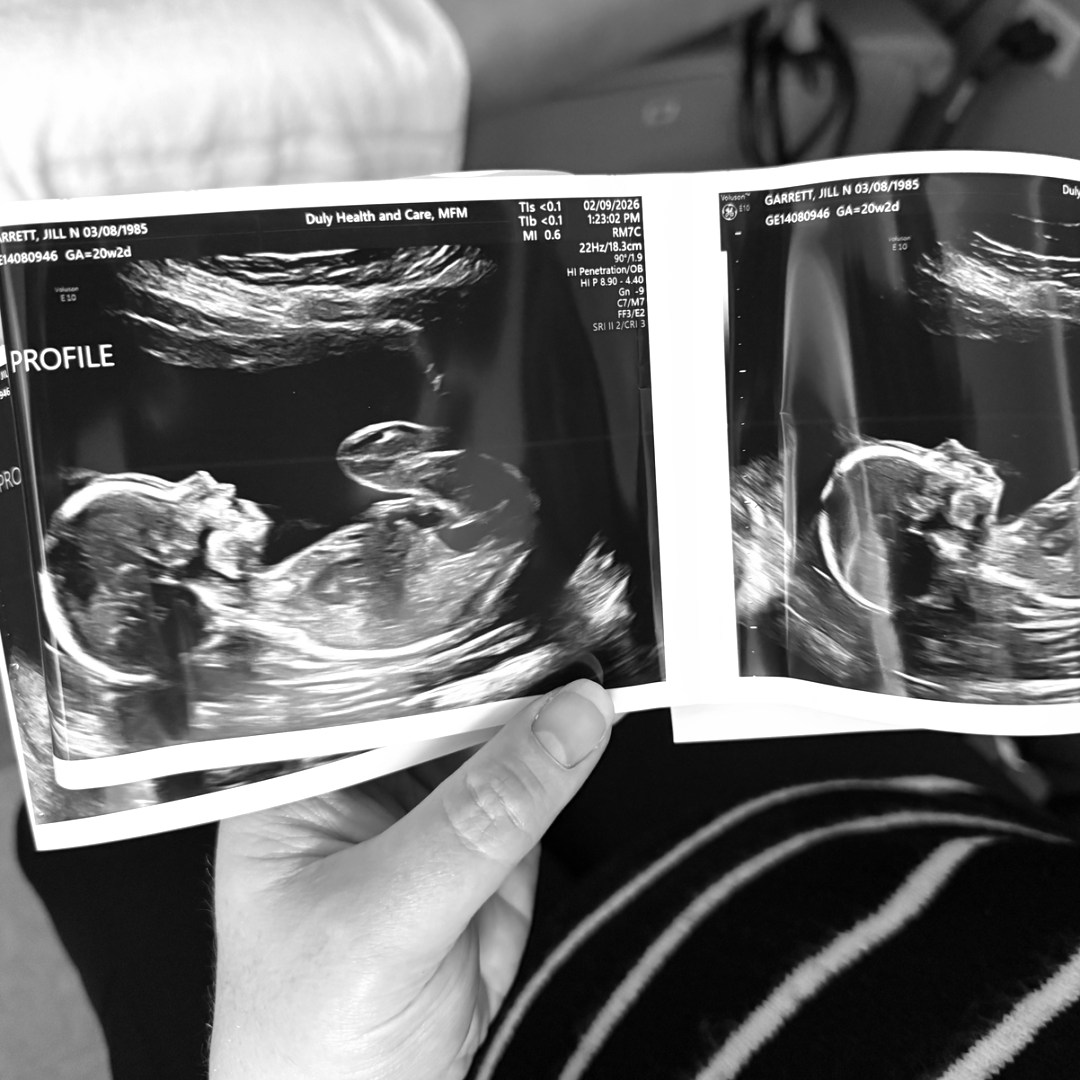 Photo shared by Jill for their Babylist baby registry.