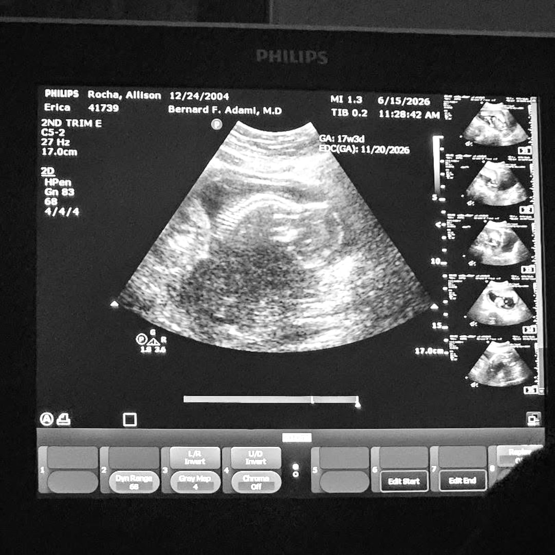 Photo shared by Allison for their Babylist baby registry.