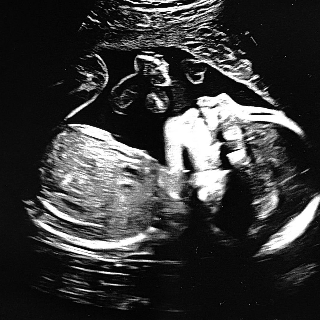 Photo shared by Clarissa for their Babylist baby registry.