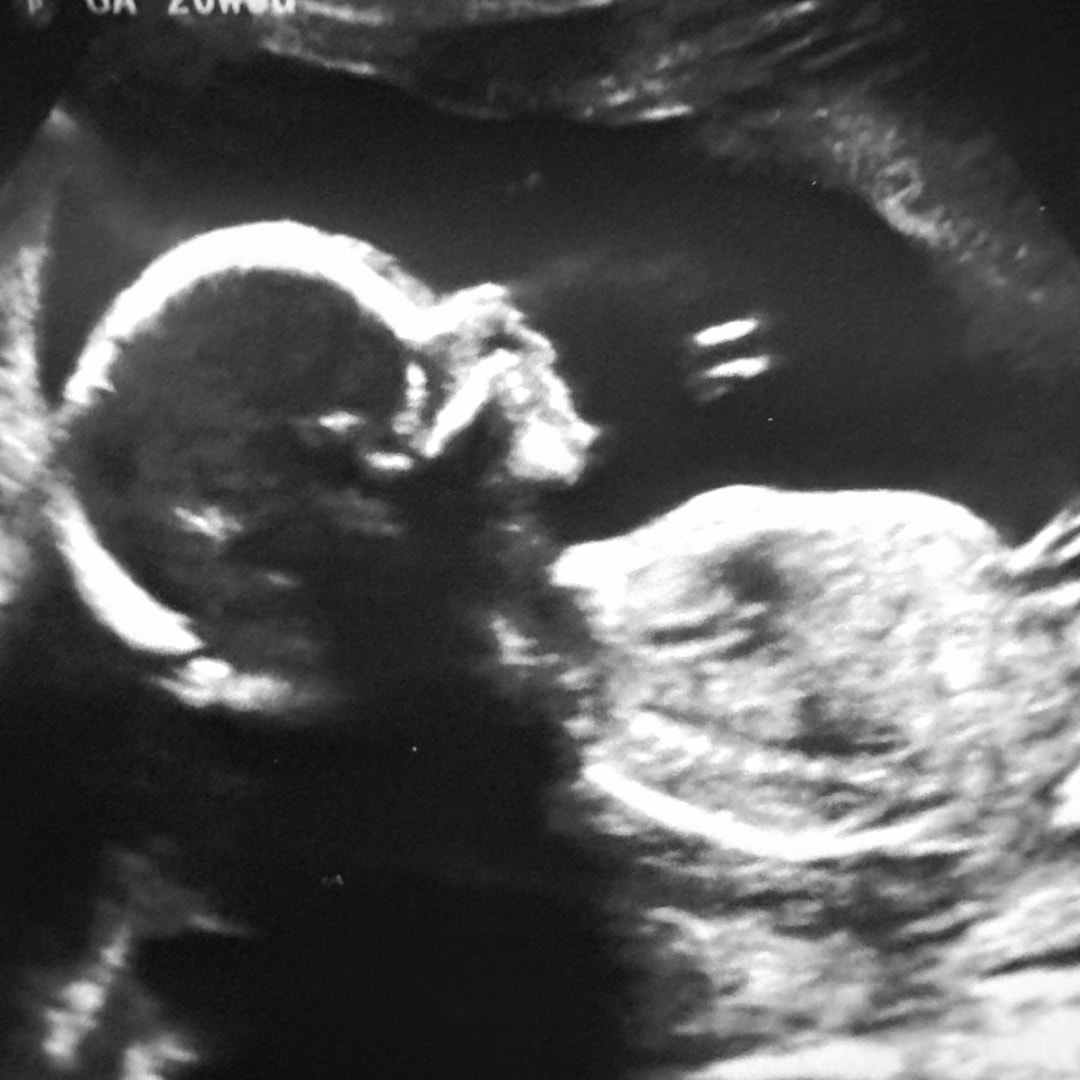 Photo shared by Gley for their Babylist baby registry.