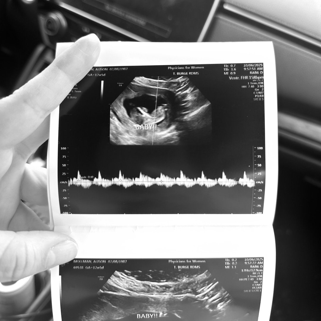 Photo shared by Stef for their Babylist baby registry.