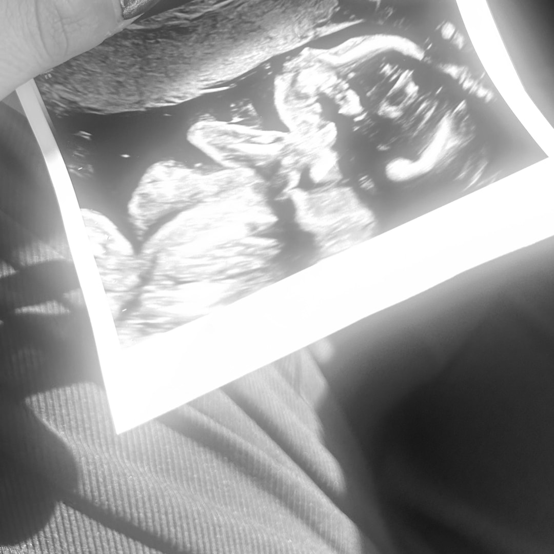 Photo shared by Ashley for their Babylist baby registry.