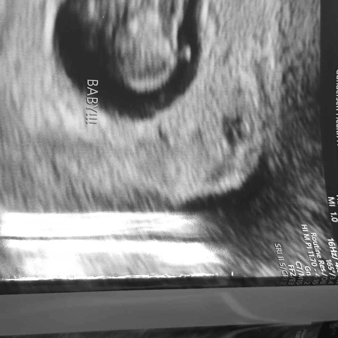 Photo shared by Kiersten for their Babylist baby registry.