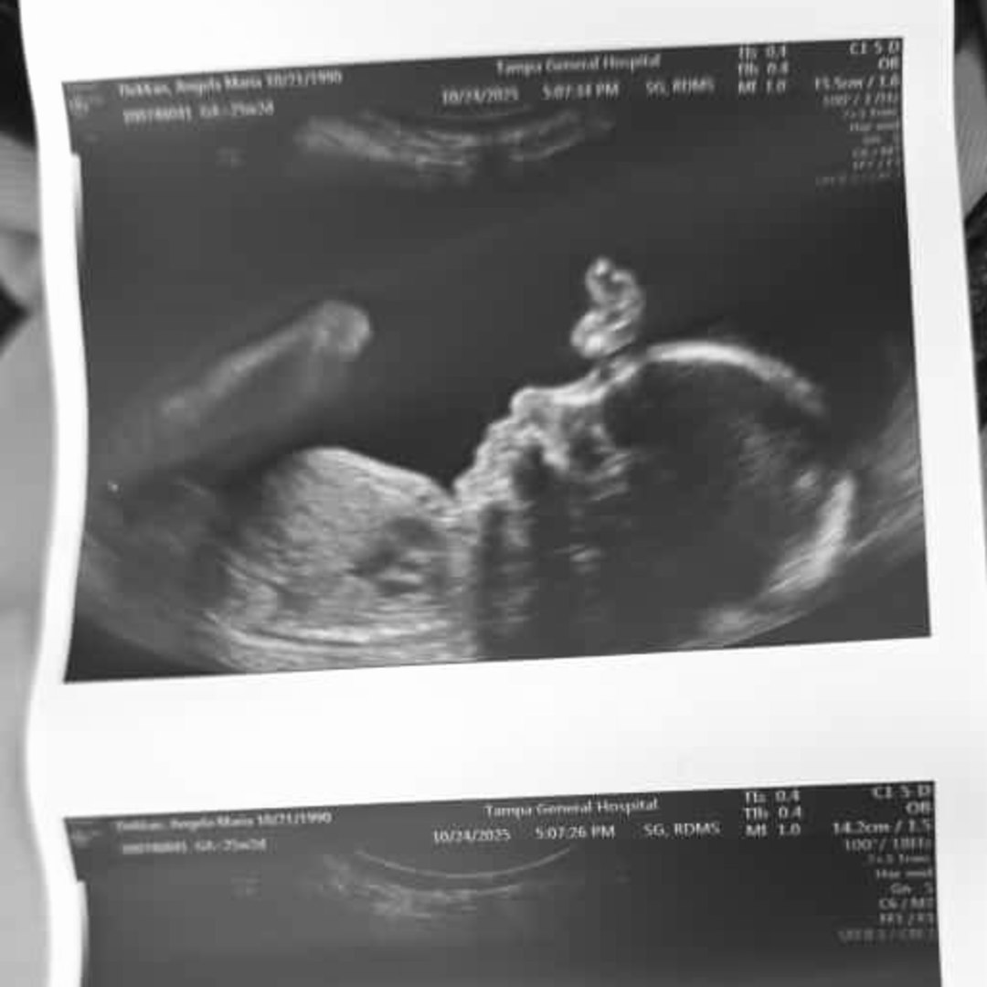 Photo shared by Angela for their Babylist baby registry.