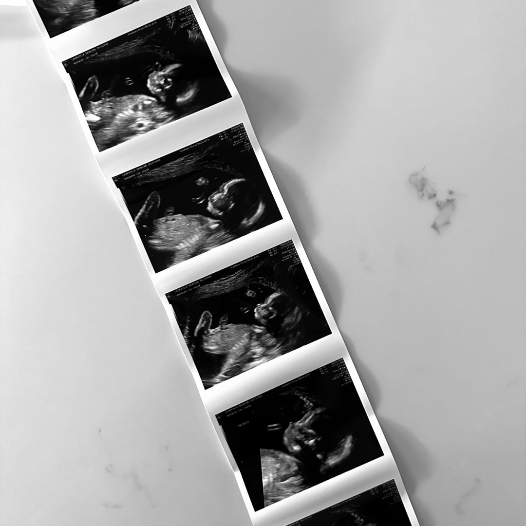 Photo shared by Morgan for their Babylist baby registry.