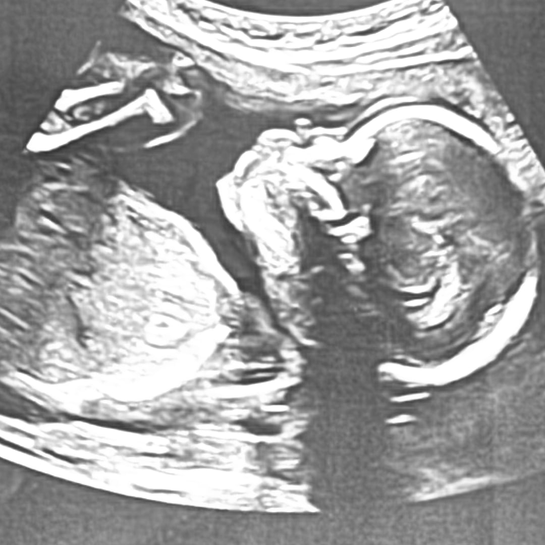 Photo shared by Carrington for their Babylist baby registry.