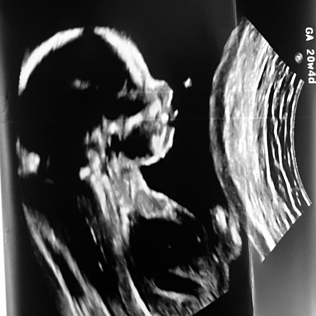 Photo shared by Karrie for their Babylist baby registry.