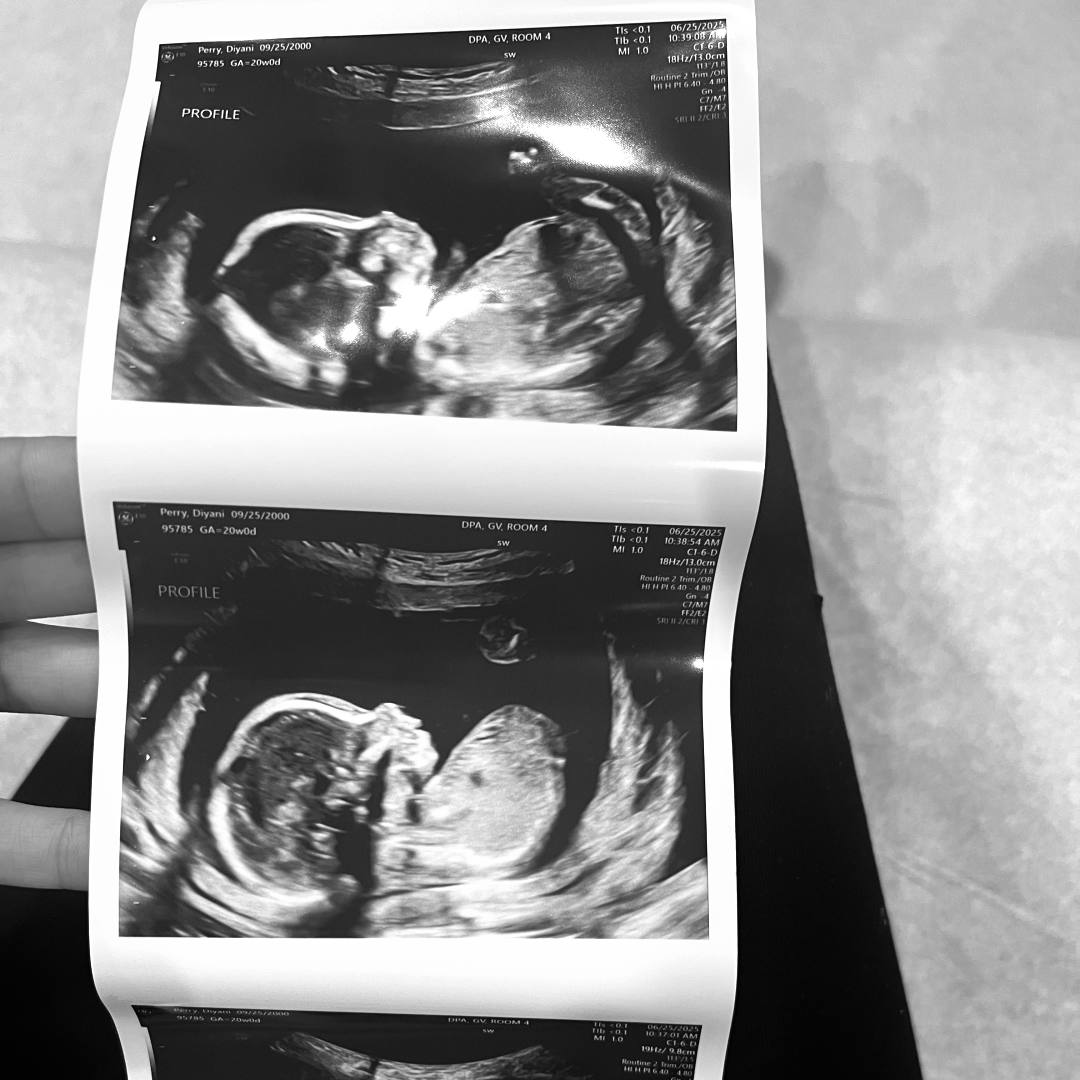 Photo shared by Diyani for their Babylist baby registry.