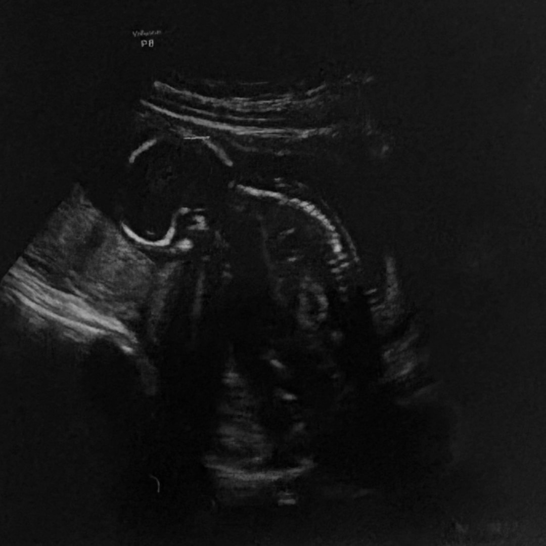 Photo shared by Lillie for their Babylist baby registry.