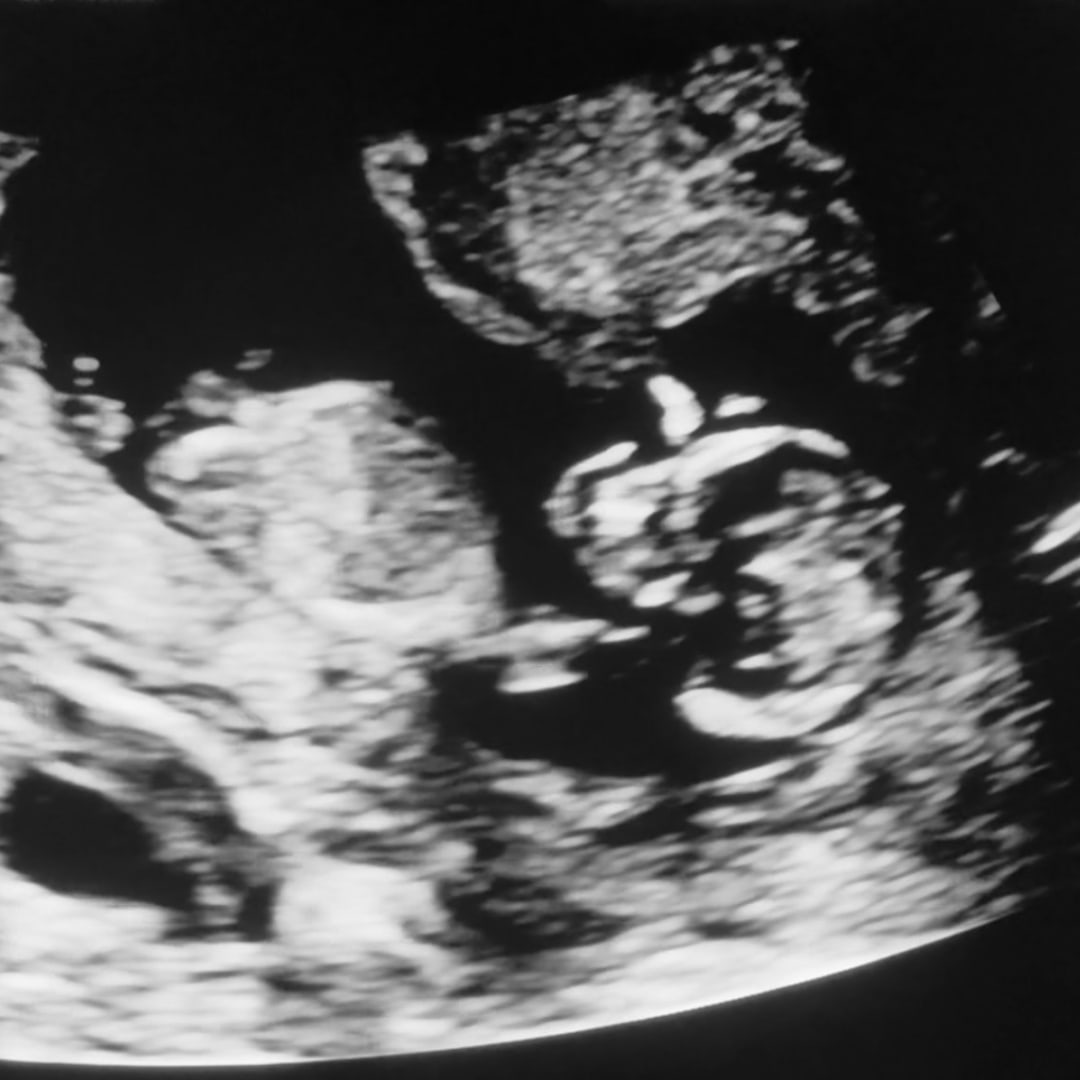 Photo shared by Yailin for their Babylist baby registry.