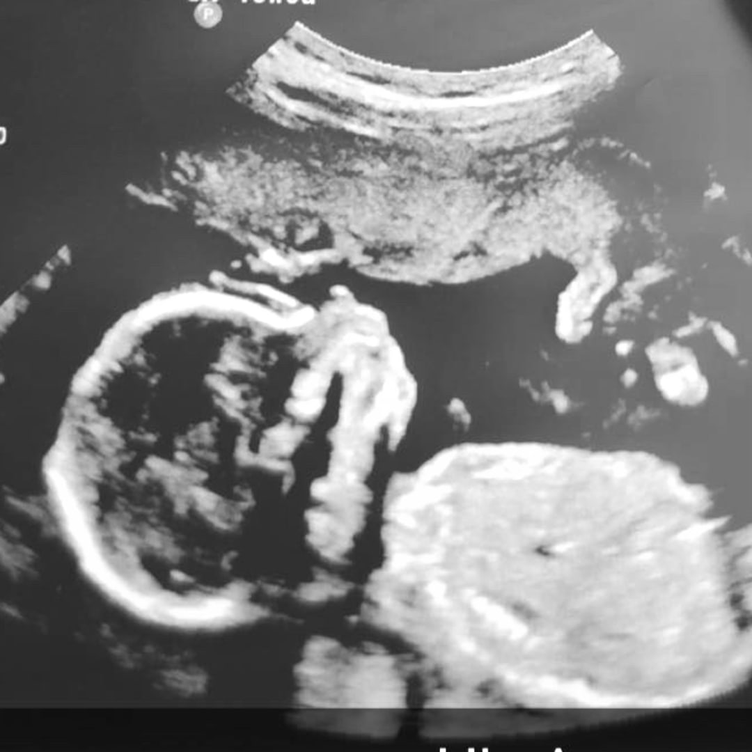 Photo shared by Brionna for their Babylist baby registry.