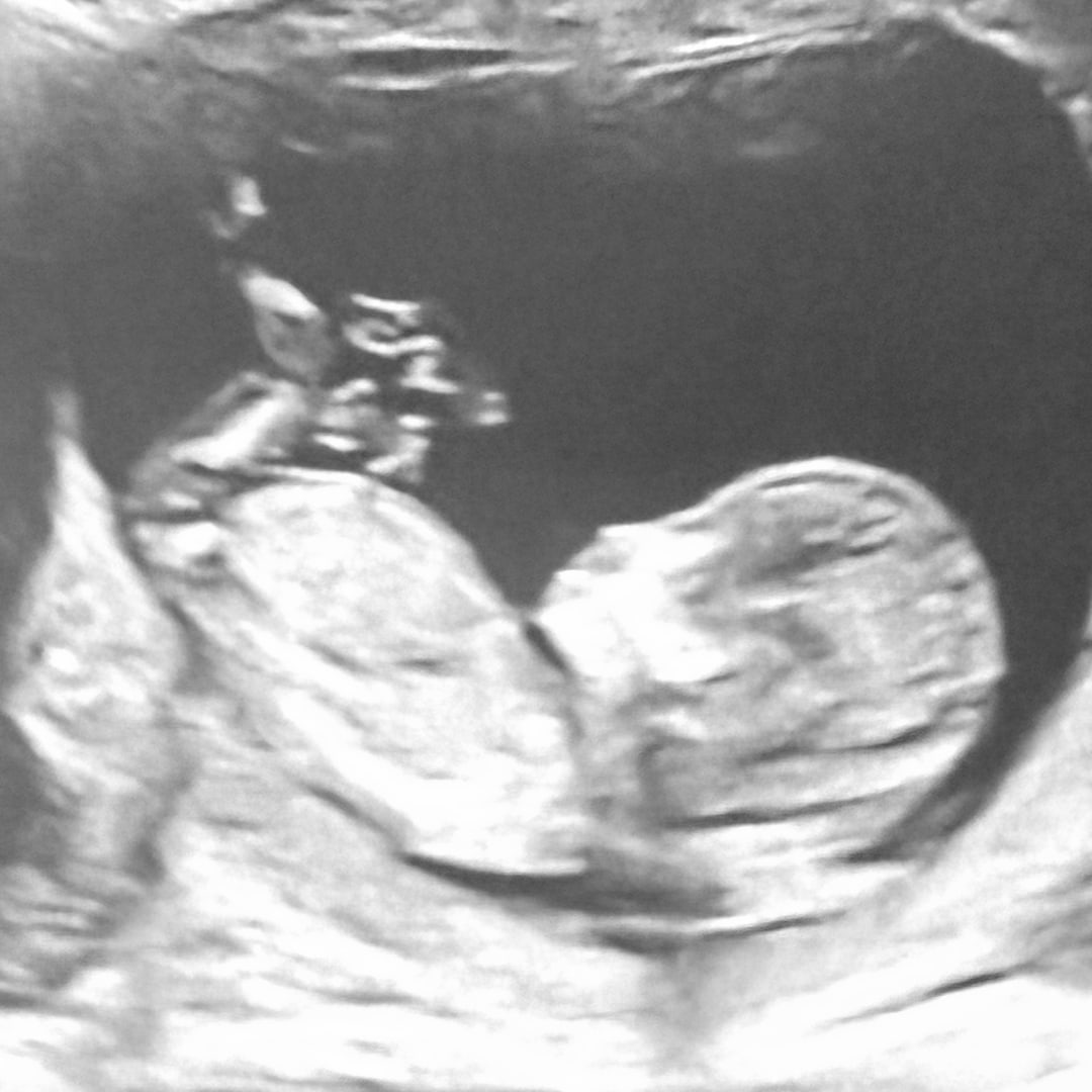 Photo shared by Daniela for their Babylist baby registry.