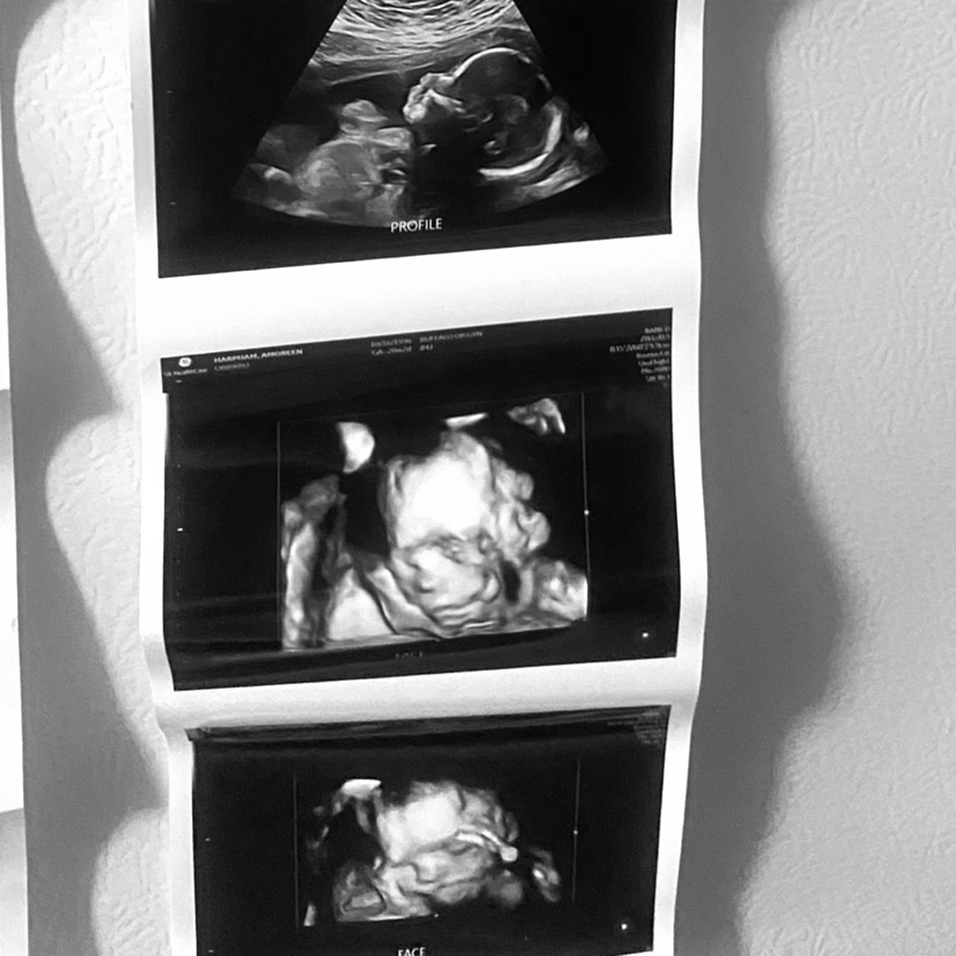 Photo shared by Amoreen for their Babylist baby registry.