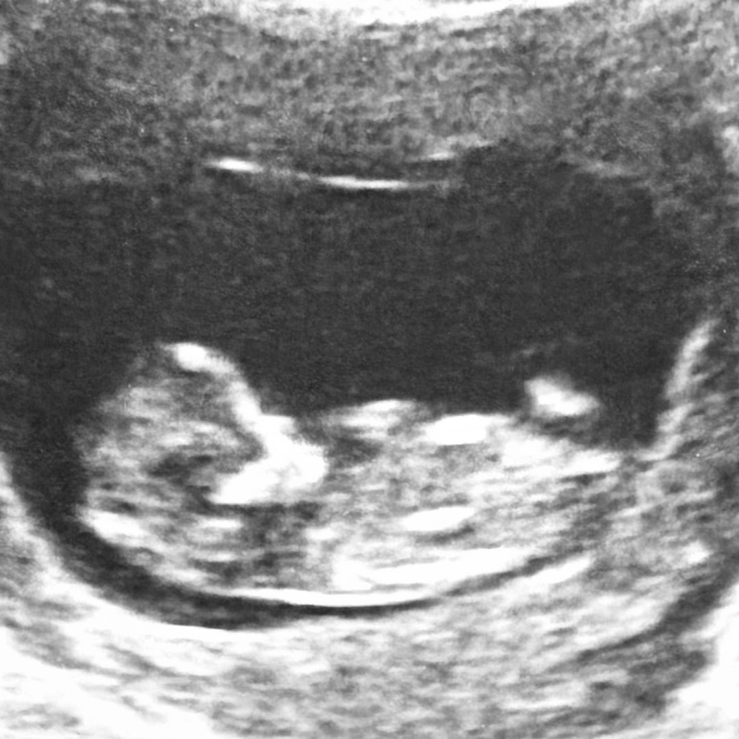 Photo shared by Dorothy for their Babylist baby registry.