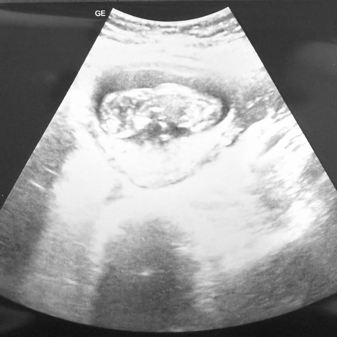 Photo shared by Emily for their Babylist baby registry.
