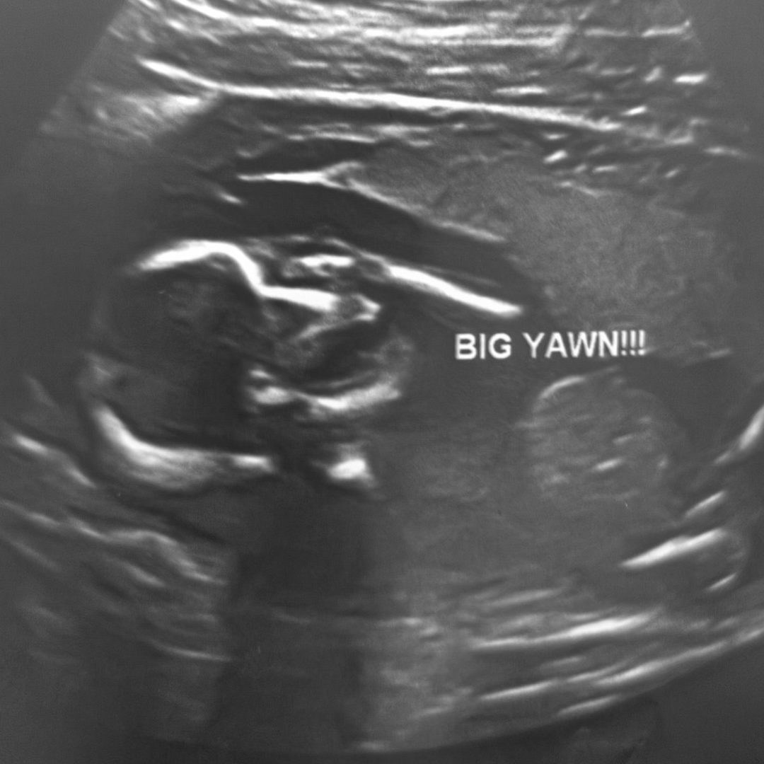 Photo shared by Carlie for their Babylist baby registry.