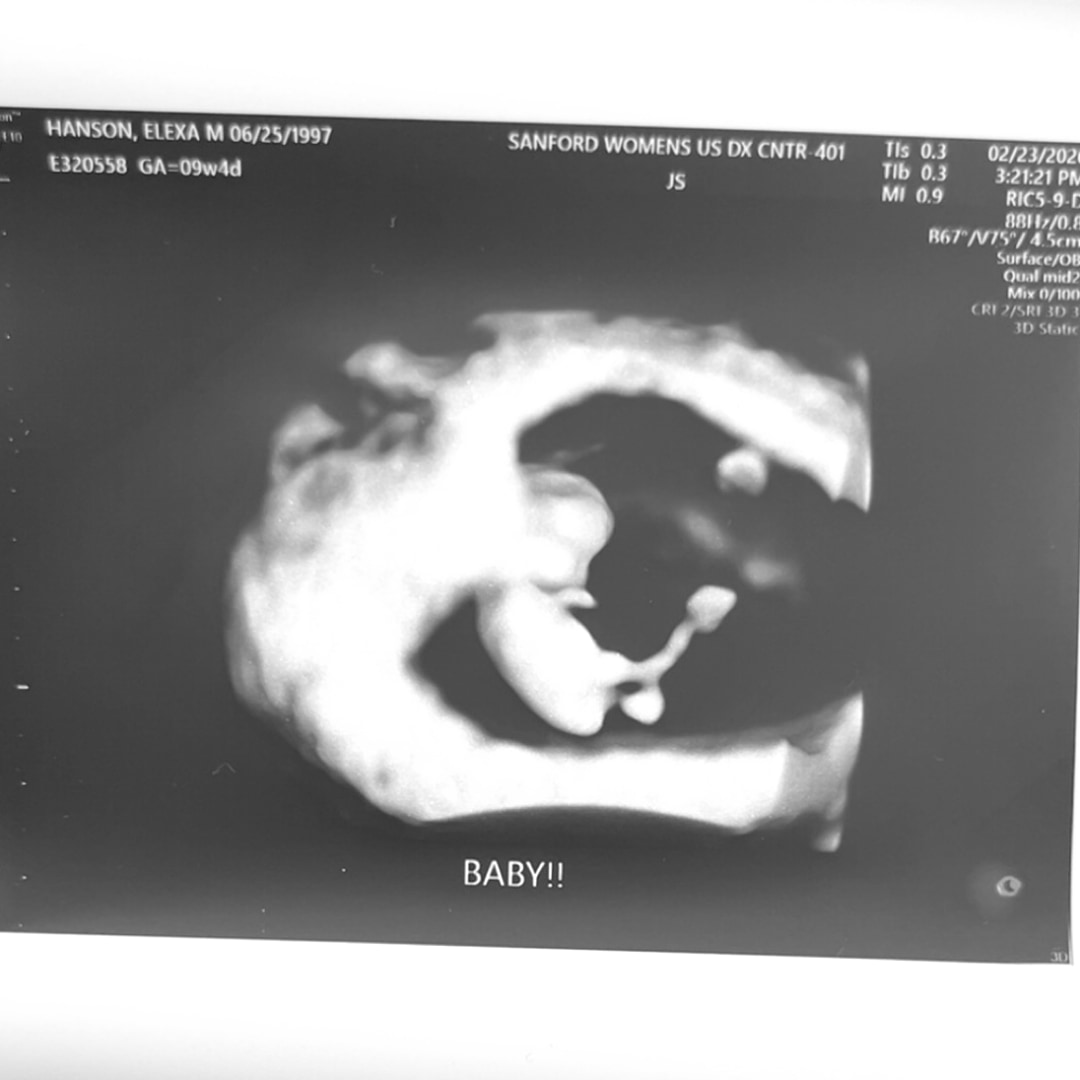 Photo shared by Elexa for their Babylist baby registry.