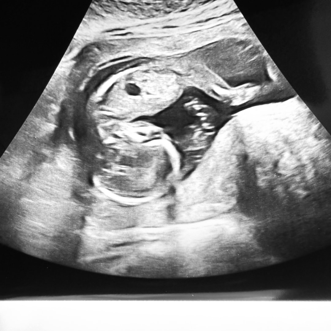 Photo shared by Karen for their Babylist baby registry.