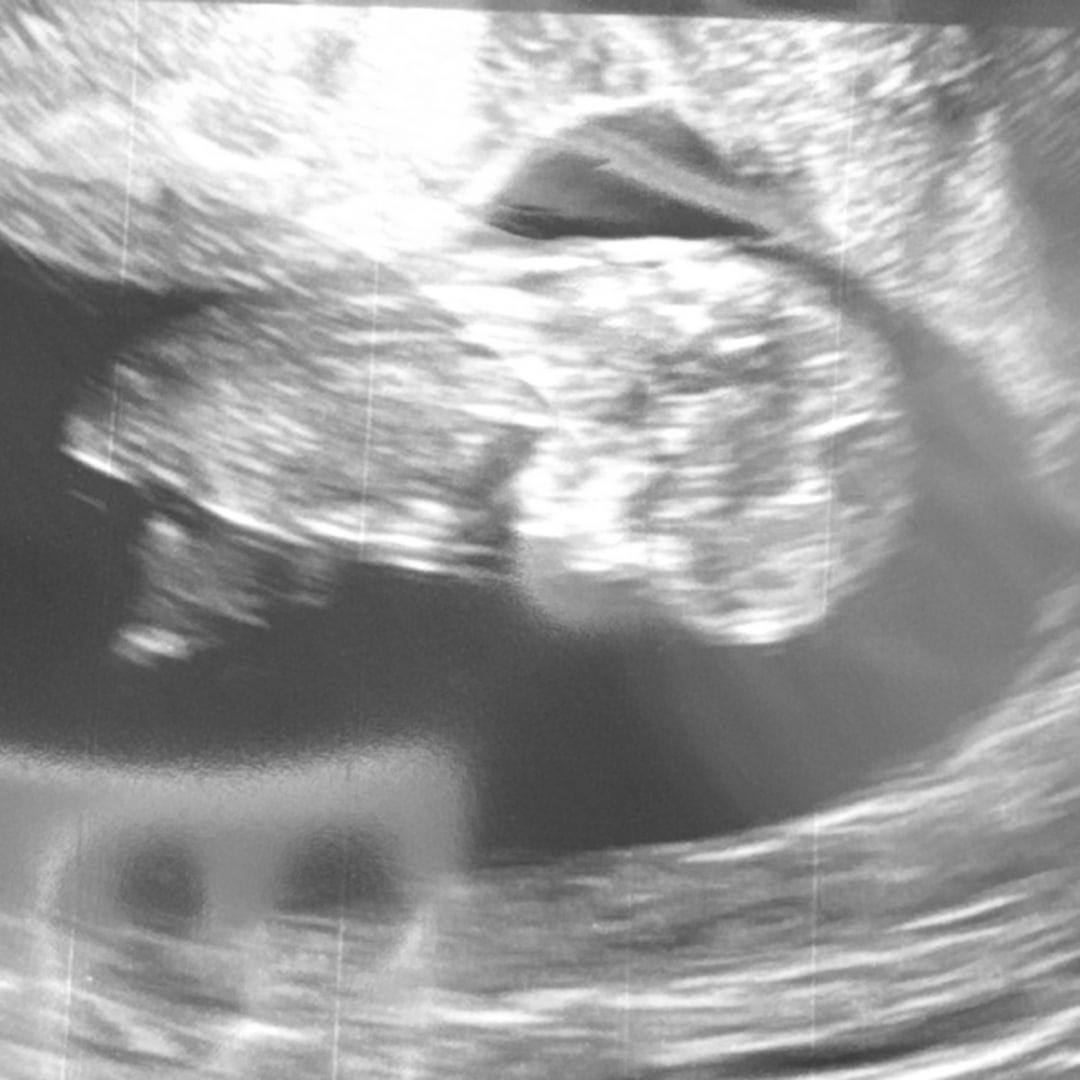 Photo shared by Brittany for their Babylist baby registry.