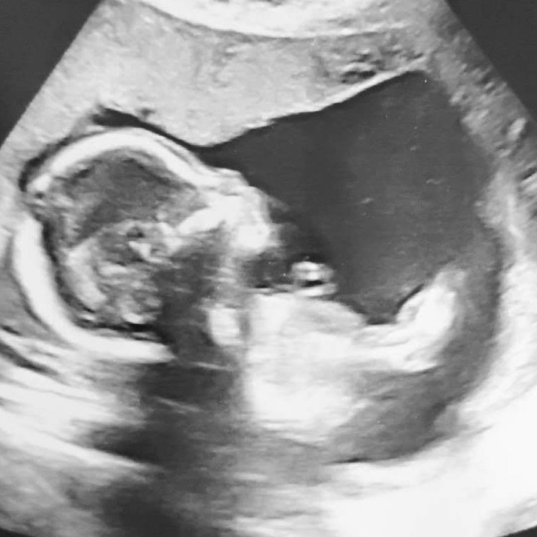 Photo shared by Joan for their Babylist baby registry.