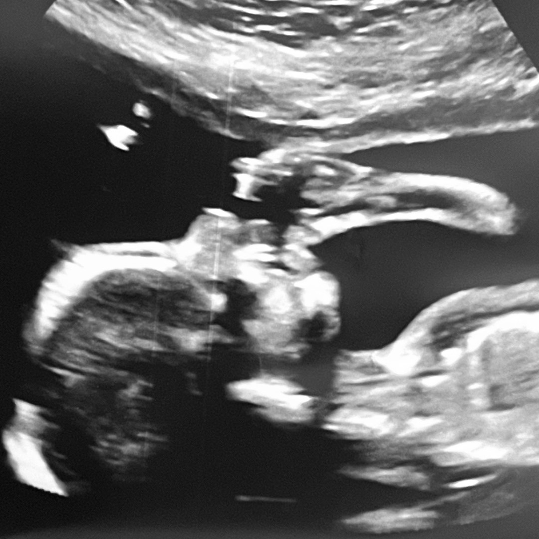 Photo shared by Karrie for their Babylist baby registry.