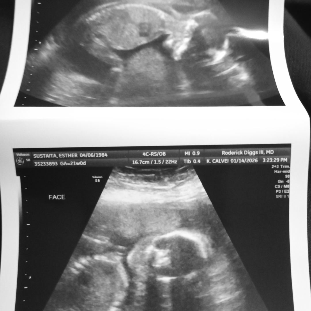 Photo shared by Esther for their Babylist baby registry.