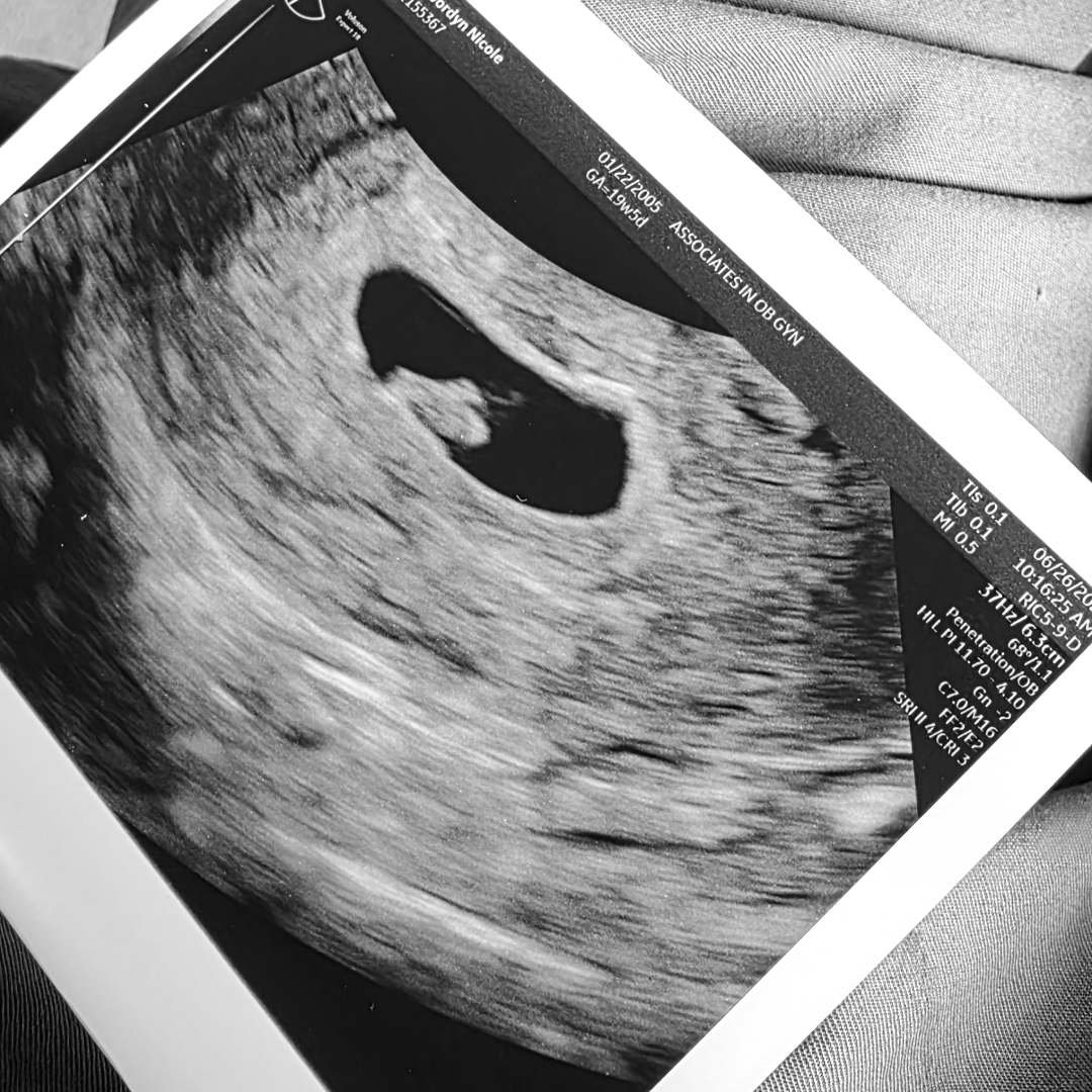 Photo shared by Jordyn for their Babylist baby registry.