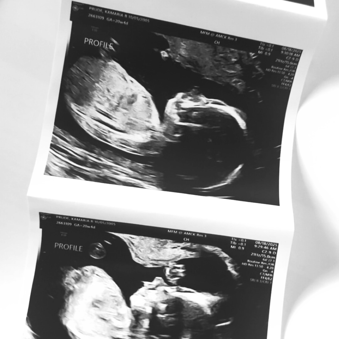 Photo shared by Kamaria for their Babylist baby registry.