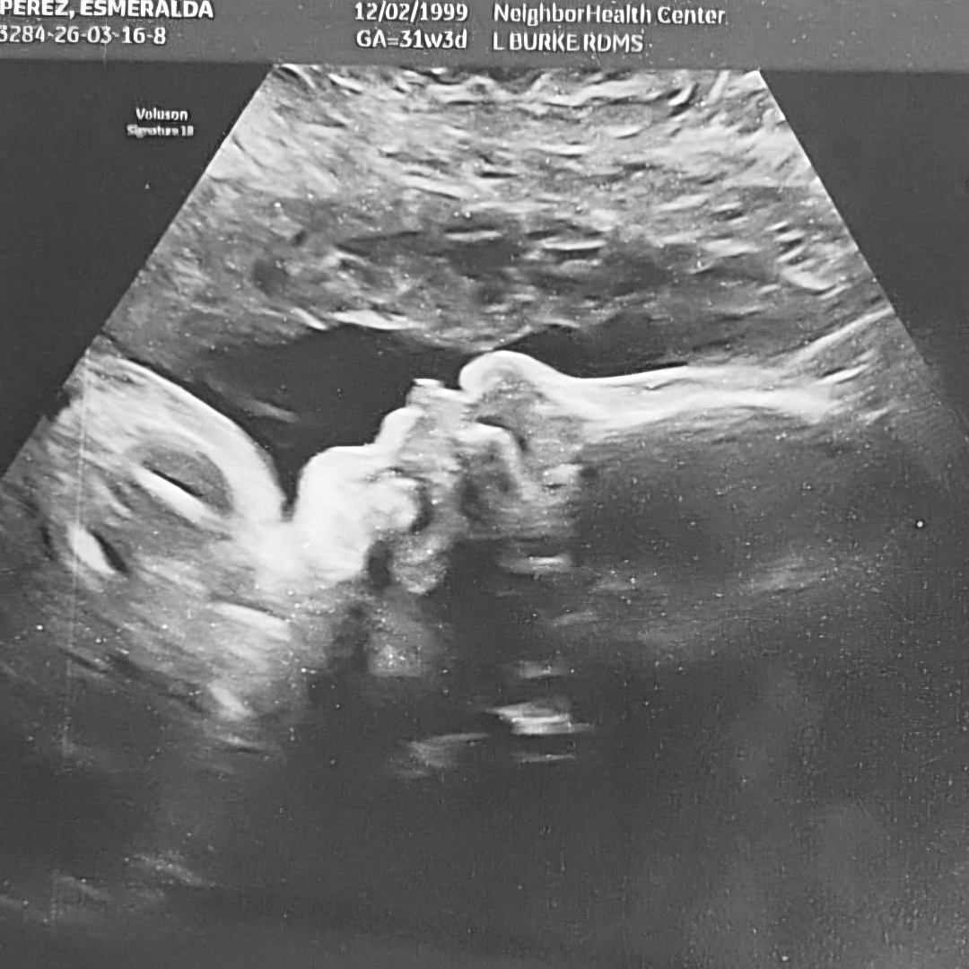 Photo shared by Esme for their Babylist baby registry.