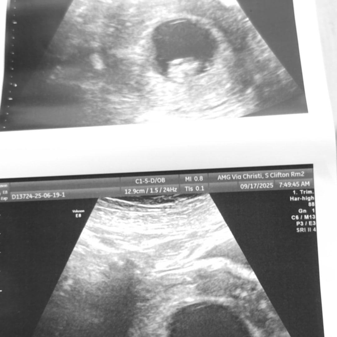 Photo shared by Erykah for their Babylist baby registry.