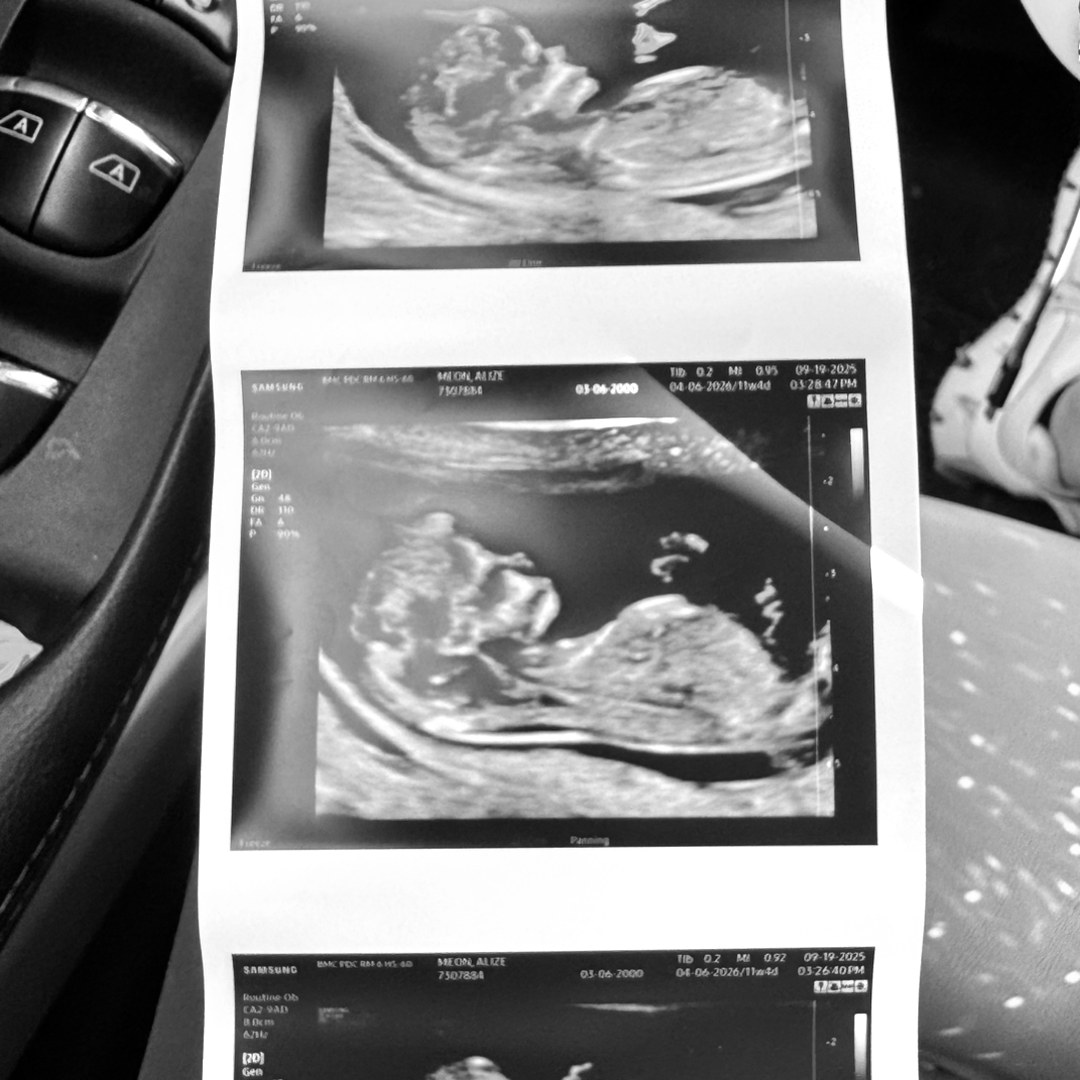 Photo shared by Alize for their Babylist baby registry.