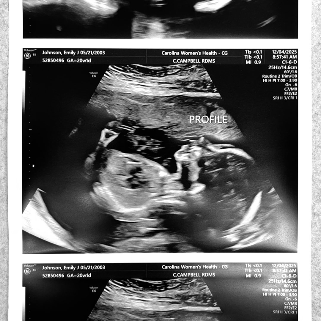 Photo shared by Emily for their Babylist baby registry.