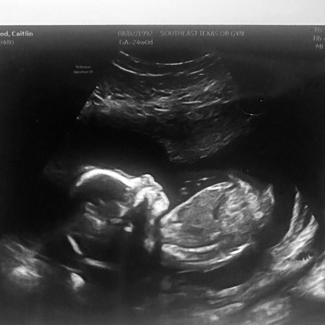 Photo shared by Caitlin for their Babylist baby registry.