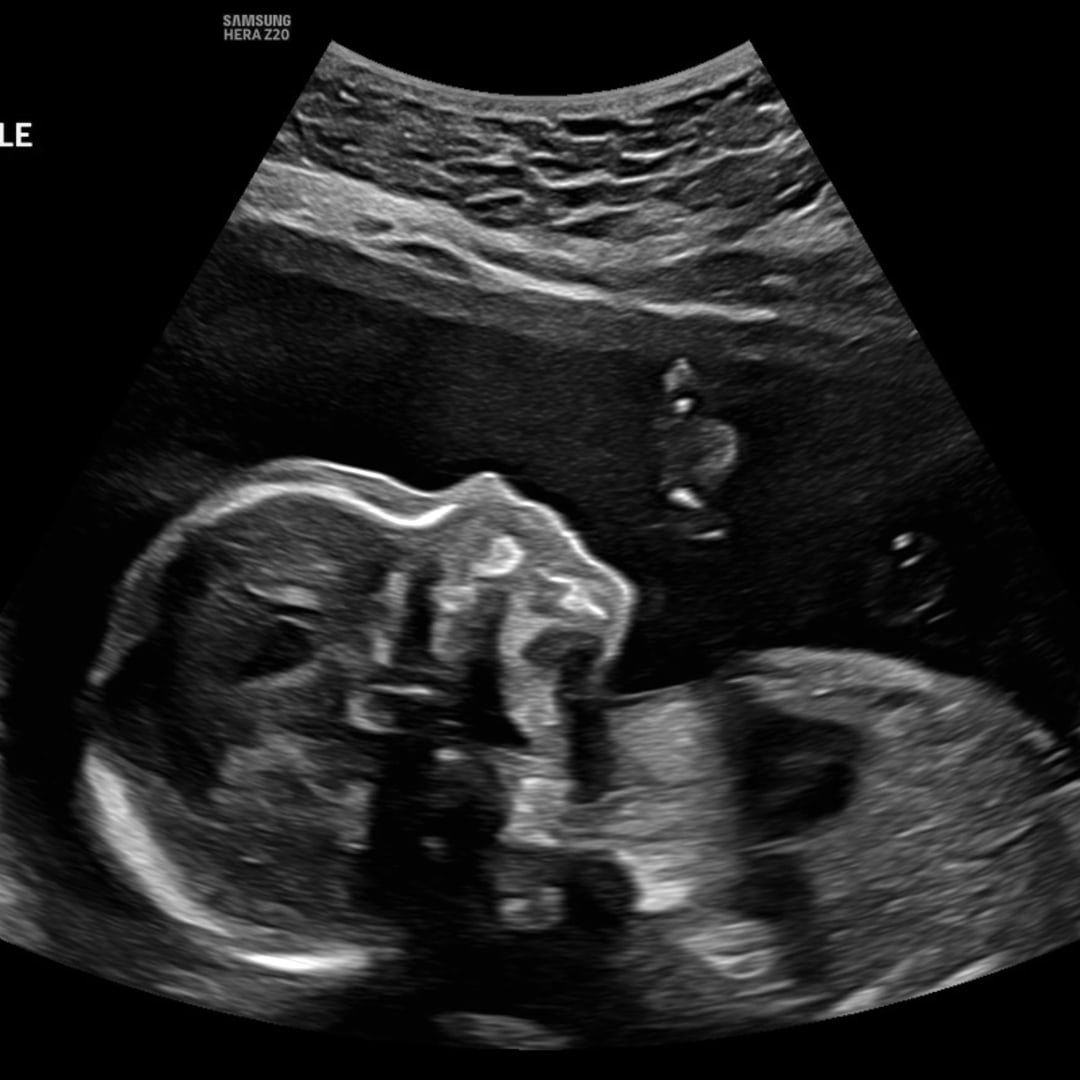 Photo shared by Patricia for their Babylist baby registry.