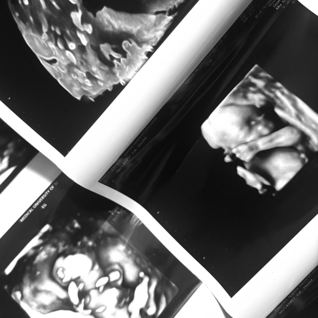 Photo shared by Iyanna for their Babylist baby registry.
