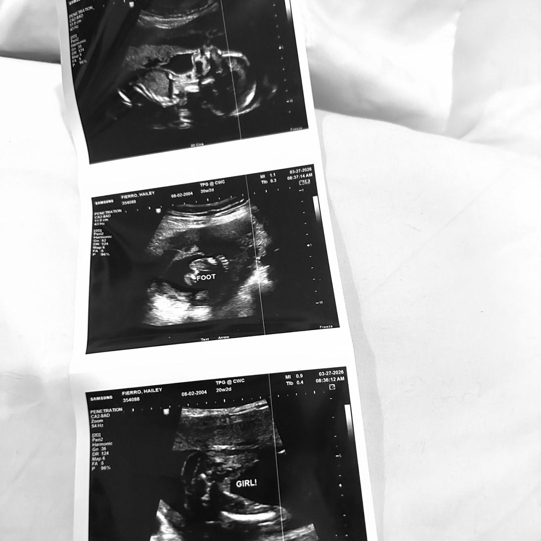 Photo shared by Hailey for their Babylist baby registry.