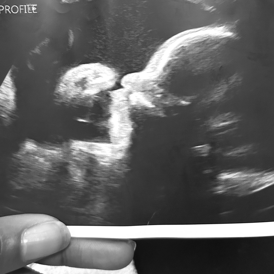 Photo shared by Sabrina for their Babylist baby registry.