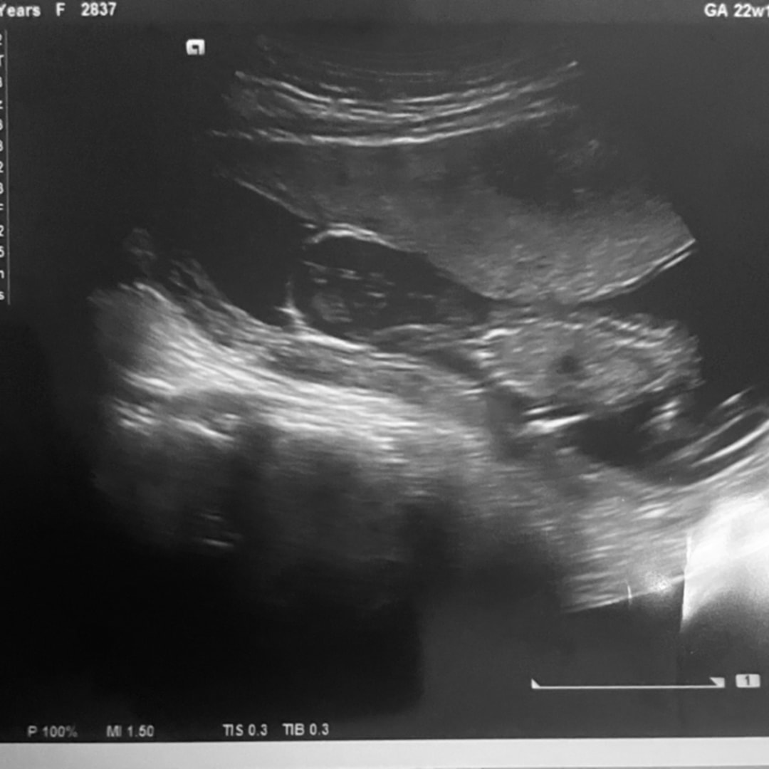 Photo shared by Krystynna for their Babylist baby registry.